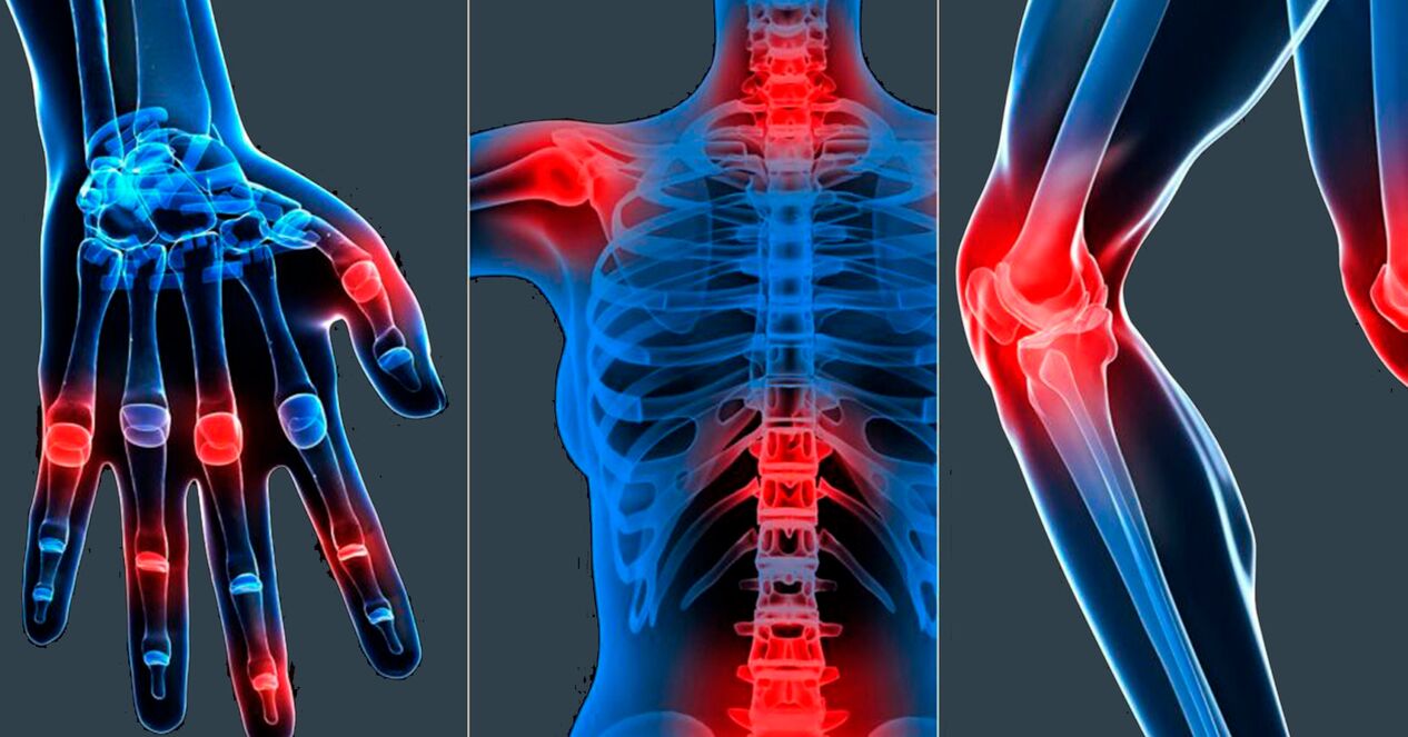Näidustused Boswellia ekstrakti kasutamiseks kapslites