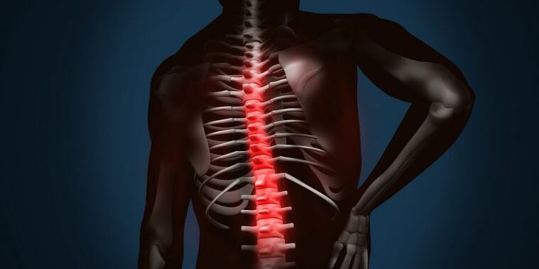 osteokondroosist tingitud selgroo kahjustused